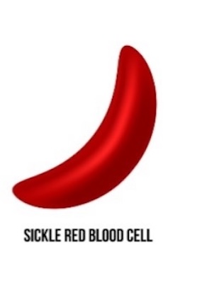 A Sickle Red Blood Cell